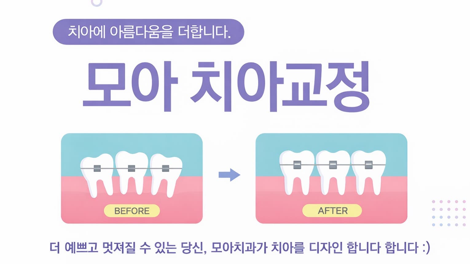 배너 3